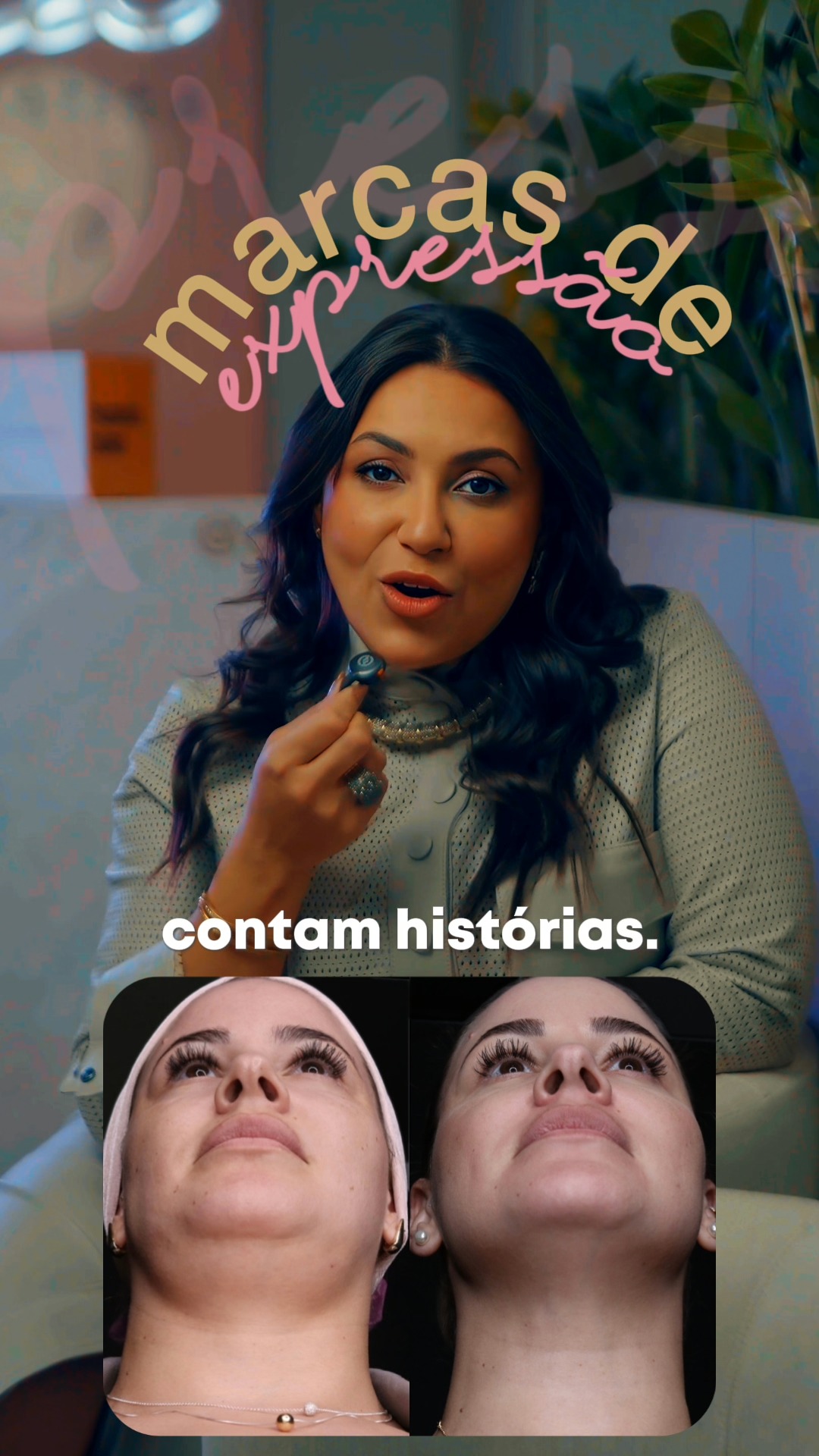 Suas marcas contam histórias! Mas o seu rosto não precisa carregar o peso de todas elas.

Marcas de expressão, cicatrizes, quedinha de sobrancelha, flacidez… tudo isso faz parte da vida! 🤷🏻‍♀️
A diferença está em como você escolhe cuidar disso: esperando “chegar no limite” ou tratando de forma preventiva, com segurança e estratégia.

Na minha clínica, eu uso o ultrassom microfocado como alternativa real à cirurgia em muitos casos:
⚡️ sem cortes
⚡️ sem anestesia geral
⚡️ sem afastar da rotina
⚡️ com protocolos personalizados para manter você natural, só que mais firme, mais confiante e com contorno mais definido.

Não é sobre te transformar em outra pessoa...
É sobre aliviar o peso que o tempo colocou no seu rosto, sem perder quem você é! 😉

Se “naturalidade” é a palavra que você quer pro seu rejuvenescimento, escreva NATURALIDADE aqui nos comentários que eu te envio mais informações sobre o protocolo ideal pra você. ✨